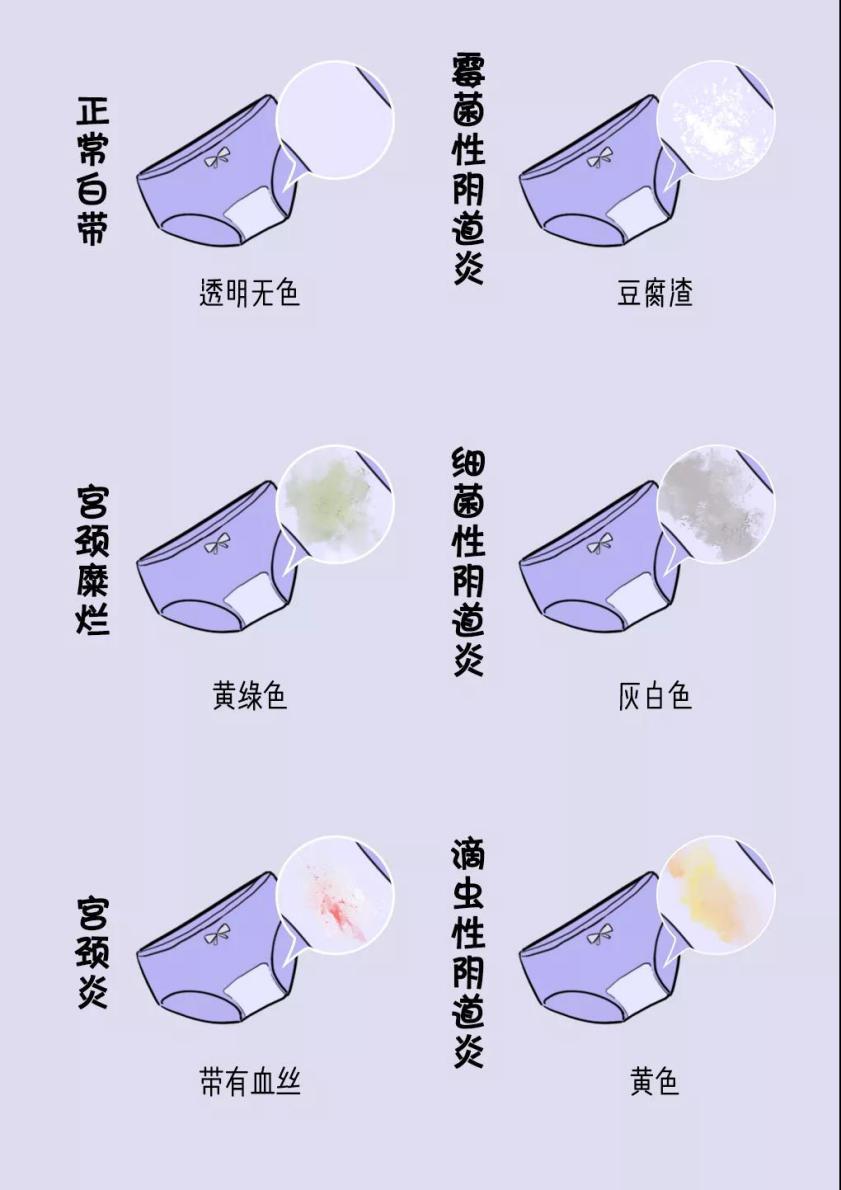 裤头发黄发硬是什么原因,内裤变得很黄为什么