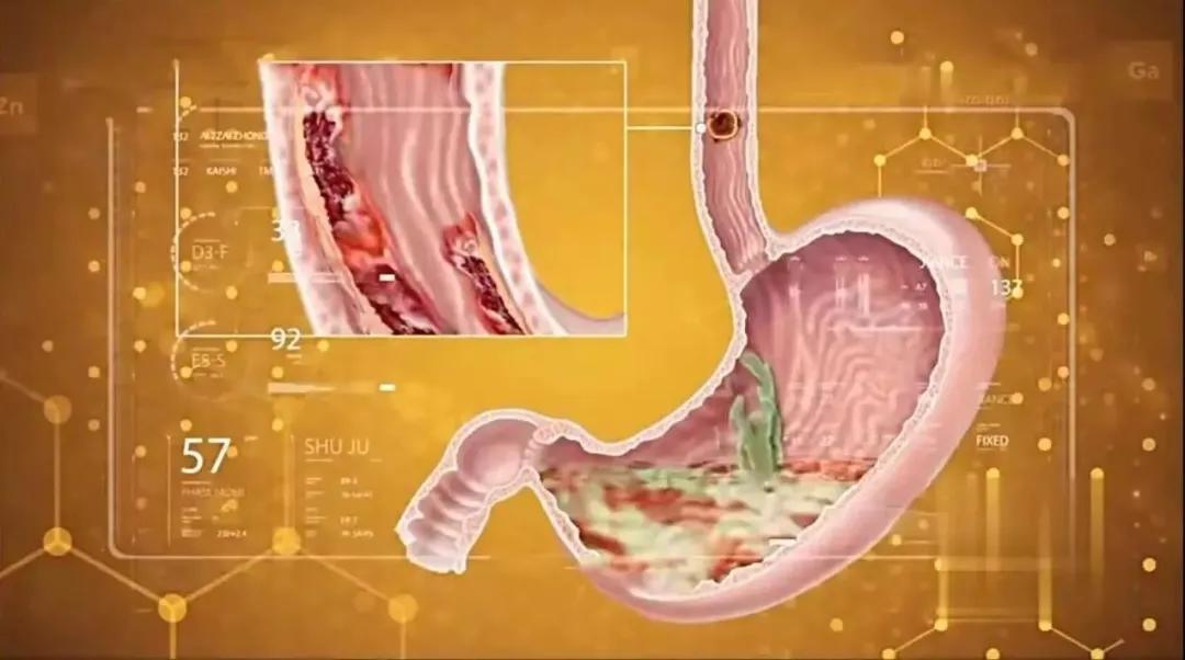 7个不起眼的坏习惯，可能从头到脚伤害你！第三个就有很多人中招
