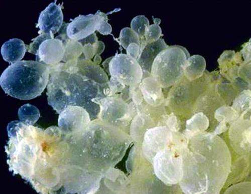 难道我的宝宝是葡萄？