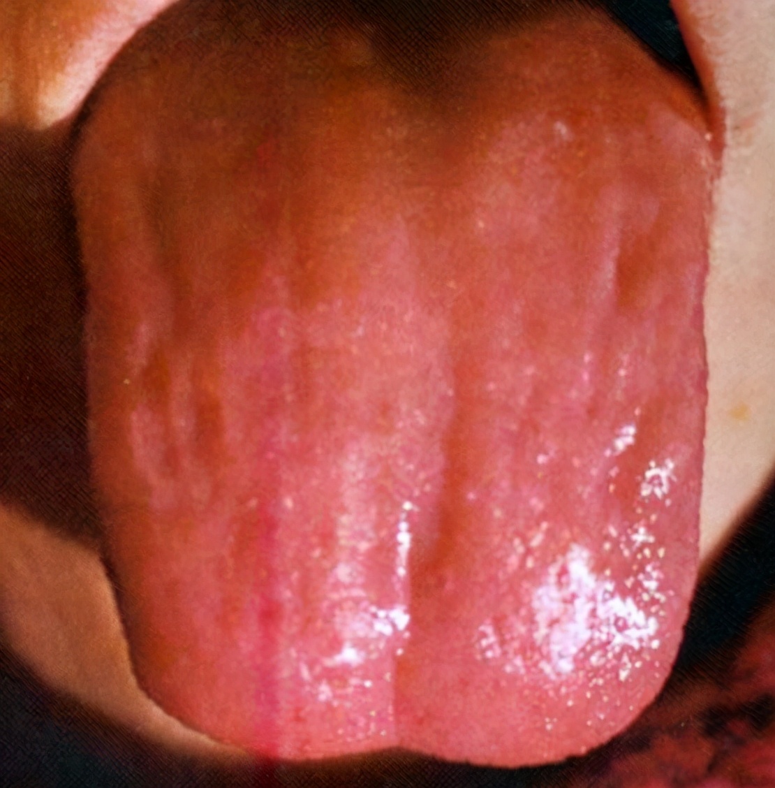 关于阴虚症状与治疗,阴虚出现的问题分析