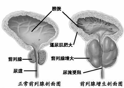前列腺是人体的哪个部位,前列腺是谁
