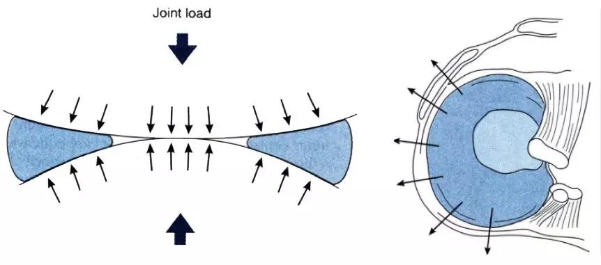 运动导致的半月板损伤的最好治疗,运动后半月板损伤怎么治疗