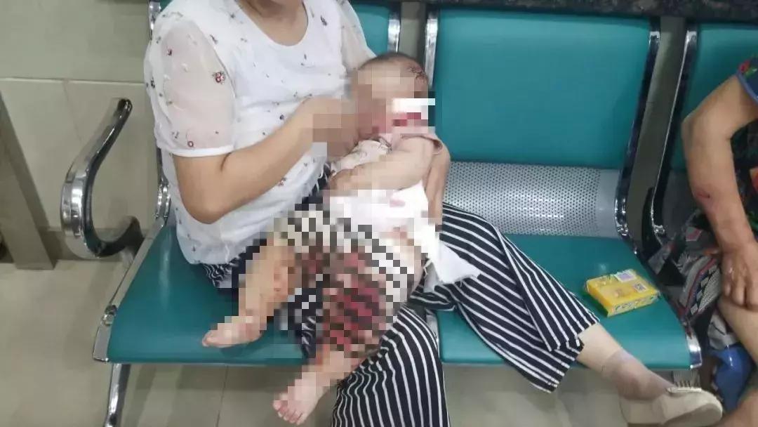 男子被一只狗疯咬,狗被狗咬出血会自愈吗