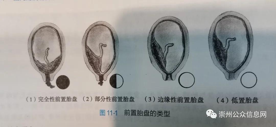 崇州妇幼儿童药物科普知识,崇州孕前检查带什么