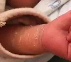 新妈妈别再乱担心了，月嫂总结宝宝的这28种情况是正常的