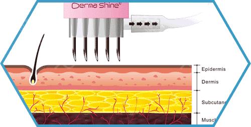 恐怖直播网红,吓人的打水光针视频