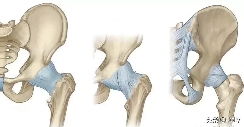 瑜伽过度开跨对身体到底好不好？