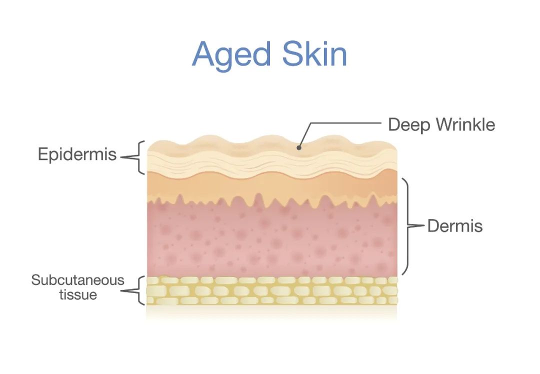 抬头纹去除真的有效吗,抬头纹法令纹真的可以消灭吗