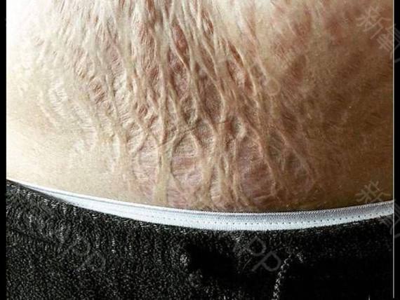 判断女人生过孩子最简单方法,如何一眼判断女性是否生过孩子