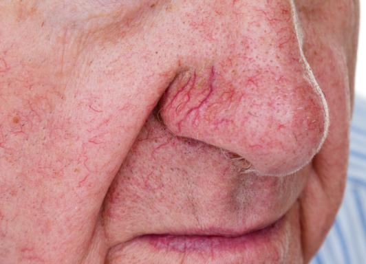 肝不好出现2痒3黑,肝不好的人会出现一痒二痛三黄