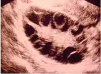 要宝宝的最佳时期,一般几月份备孕生娃好