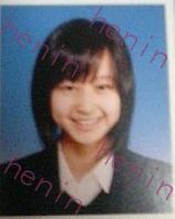 这个你察觉不到的小手术，滨崎步和80%的日本女星都做过它