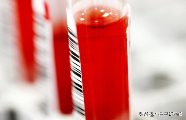 人类死亡后身体的恐怖变化,人类死之后身体会发生哪些变化