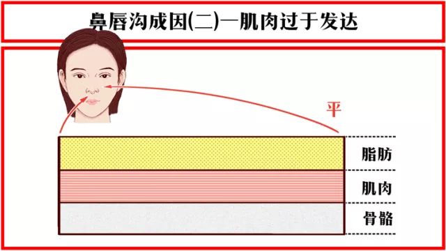 法令纹显老10岁三种方法帮助改善,最显老的法令纹怎么改善