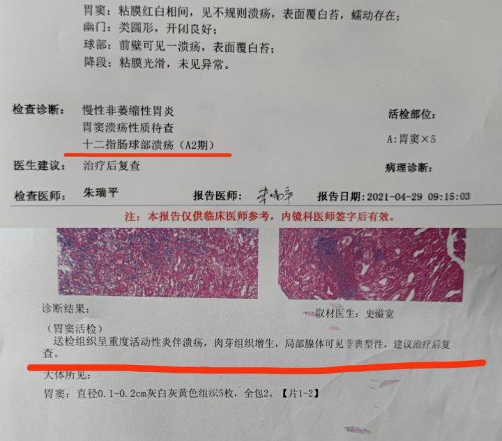肠造口护理用品使用方法照片,造口护理技术操作需要几分钟