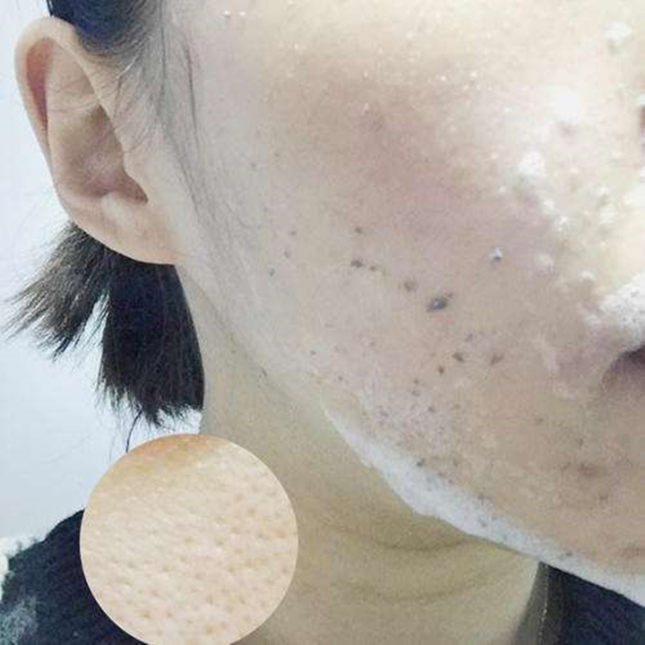 小孩被晒黑了怎么才能快速变白,男人皮肤晒黑了怎么快速变白