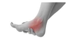 胫骨平台塌陷2-3mm的治疗方法,有足弓但是是扁平足怎么办