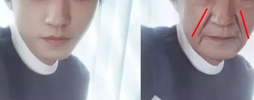 一招帮你搞定淡化法令纹,教你一招二天消除法令纹