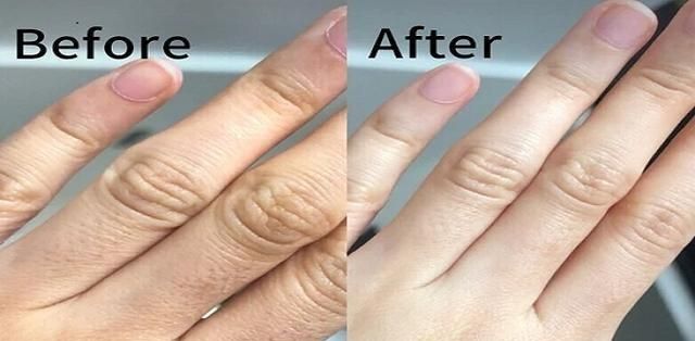 如何将手部快速变得光滑白嫩,双手变白嫩的小妙招