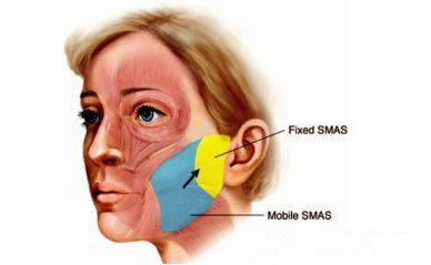 面部紧致提拉抗衰针,紧致抗衰面部训练