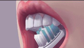 牙龈肿痛出血真的是上火吗,牙齿上火牙龈红肿怎么治疗