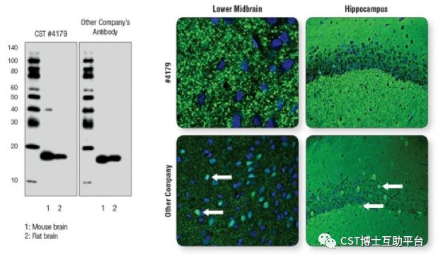 免疫荧光技术的优缺点,免疫荧光一抗二抗稀释比例