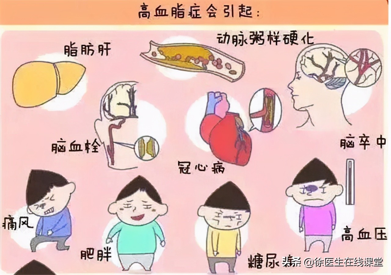 胆固醇6.6血脂3.06需要吃药吗,胆固醇跟血脂多少才需要吃药