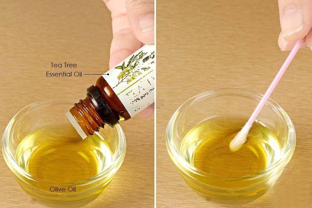 祛痘印用什么精油比较好,祛痘印精油在什么步骤用