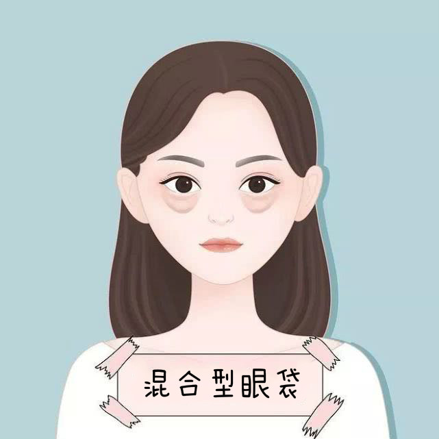 10个简单有效的去眼袋方法,4个方法去眼袋生活简单没烦恼