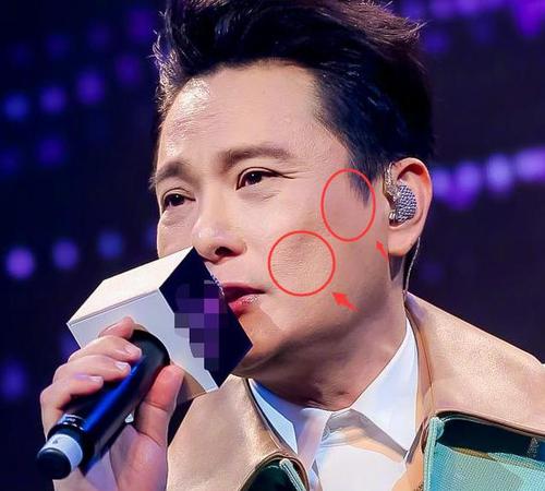 张信哲谈微整形,张信哲微整形