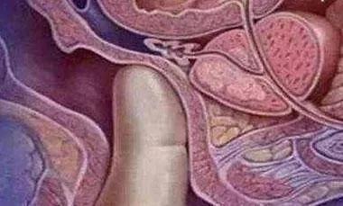 男医生的“一阳指”有多可怕？孕妈：尴尬到顶点，能避开太幸运了