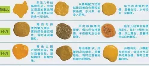 发现宝宝拉这种便便要注意了！教你如何“透过便便看本质”