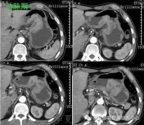 这些部位的黑色素瘤，您会诊断吗？