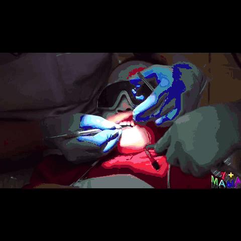 一般的刷牙方法能清除牙菌斑,小朋友牙齿有牙菌斑要洗掉吗