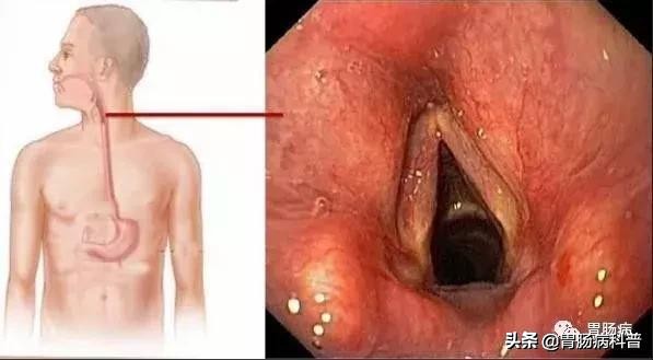医生做胃镜检查时会看食道的吗,胃镜检查全过程视频消化内科检查