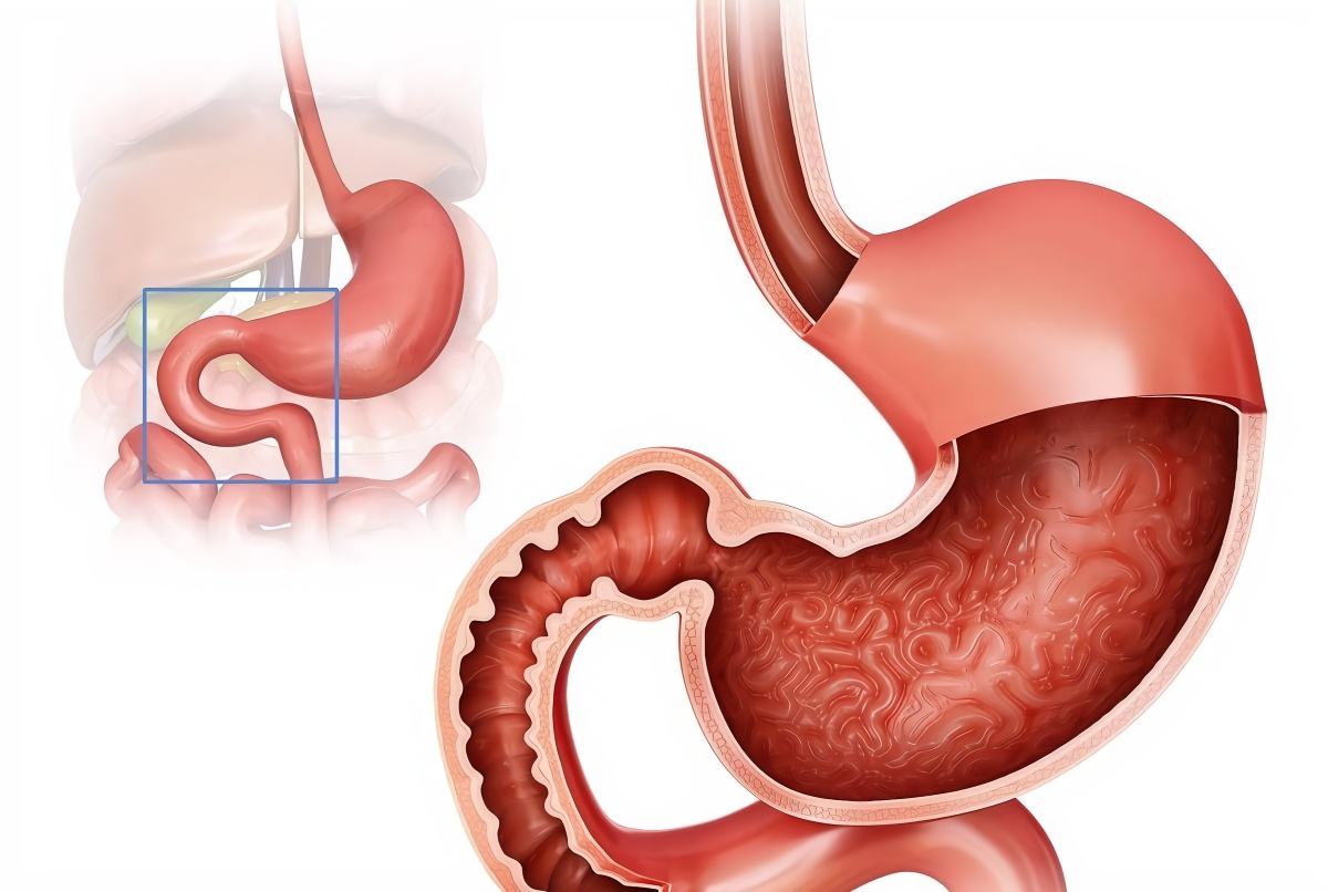 一直反酸水食道有灼烧感消化不良,胃胀胃酸烧心食管反流吃什么药好