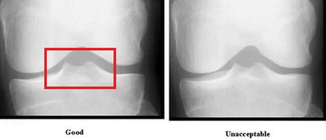 膝关节系列科普膝关节的基本结构,讲解膝关节的组成